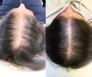 FEG HAIR GROWTH SPRAY