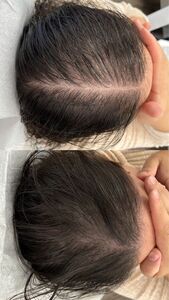 FEG HAIR GROWTH SPRAY